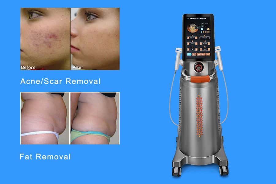Professional RF Microneedling Devices for Clinics Offering Advanced Skin Tightening Treatments - shefmon