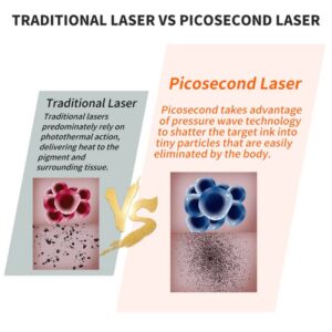 Pikosekundenlaser-Tattooentfernungsgerät in meiner Nähe vor und nach dem Pikosekundenlaserstift