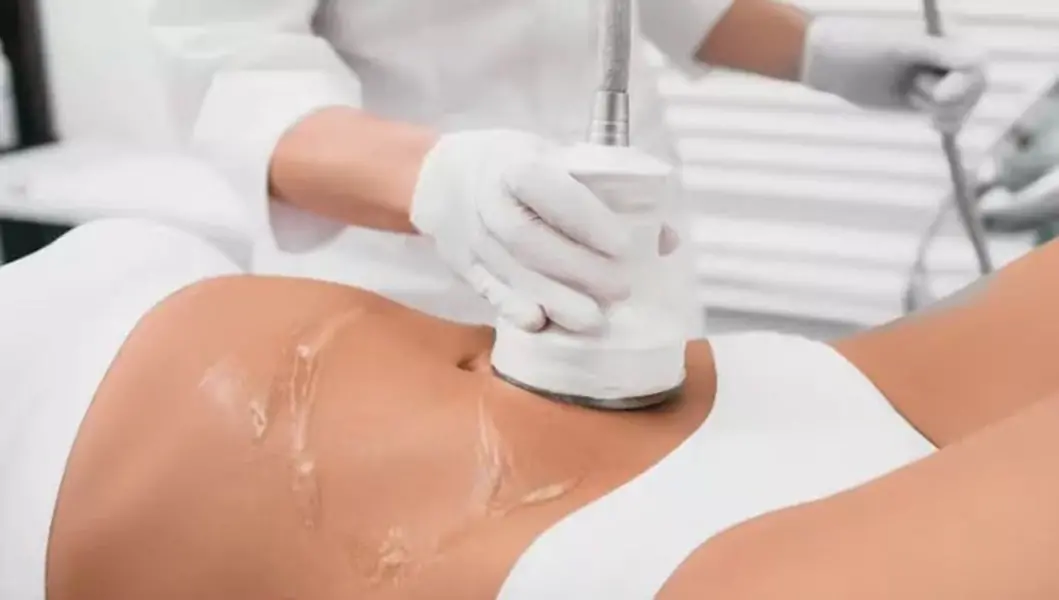 ¿Qué crema necesito para usar la máquina de reducción de cavitación, gel de cavitación ultrasónica, gel conductor para cavitación ultrasónica?