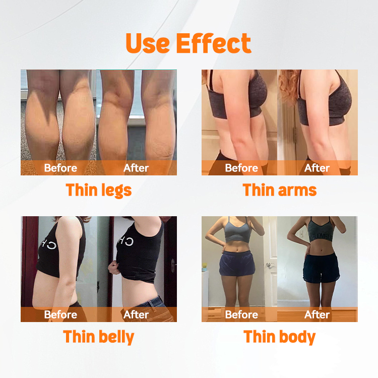 lipo laser rf radio frequency ems muscle stimulator lipo laser before and after 1 treatment does laser lipo work before and after best laser lipo machine 2024