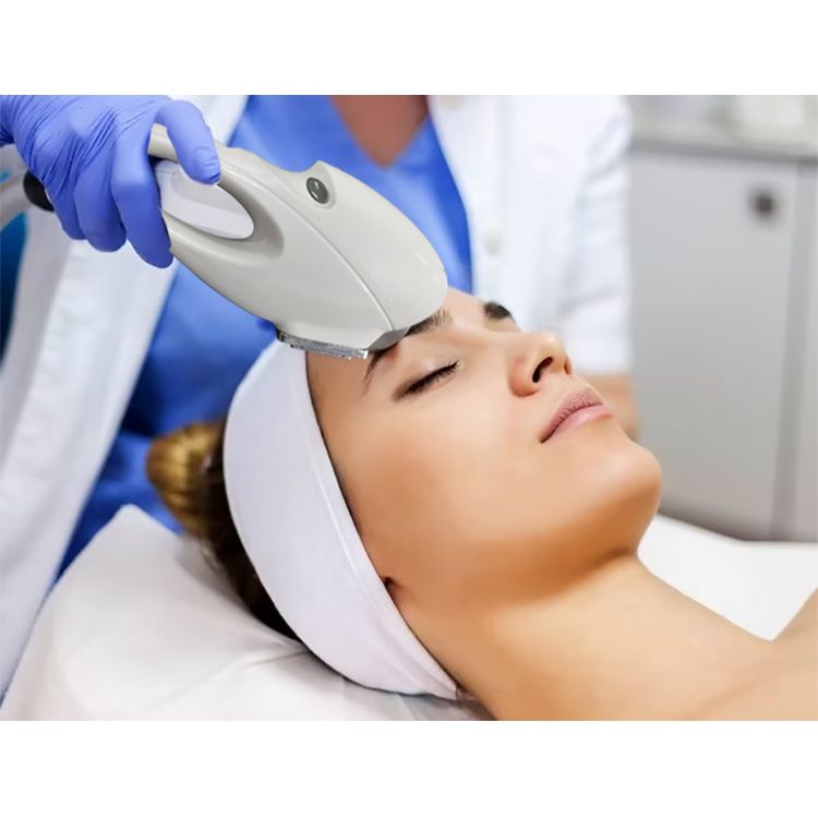 Cellular light DPL Photofacial hair removal