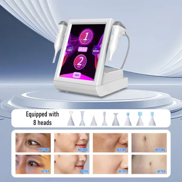 SHEFMON Coolplasma Cold Fusion Plasma Facial Skin Treatment Beauty Device A0145 - Image 4