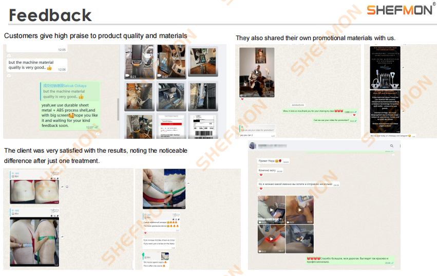 Feedback - Shefmon's After-Sales Service System