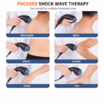 SW35 FSWT Focused Shockwave Therapy Equipment with Multi-Depth Probes for Deep Tissue - Image 3